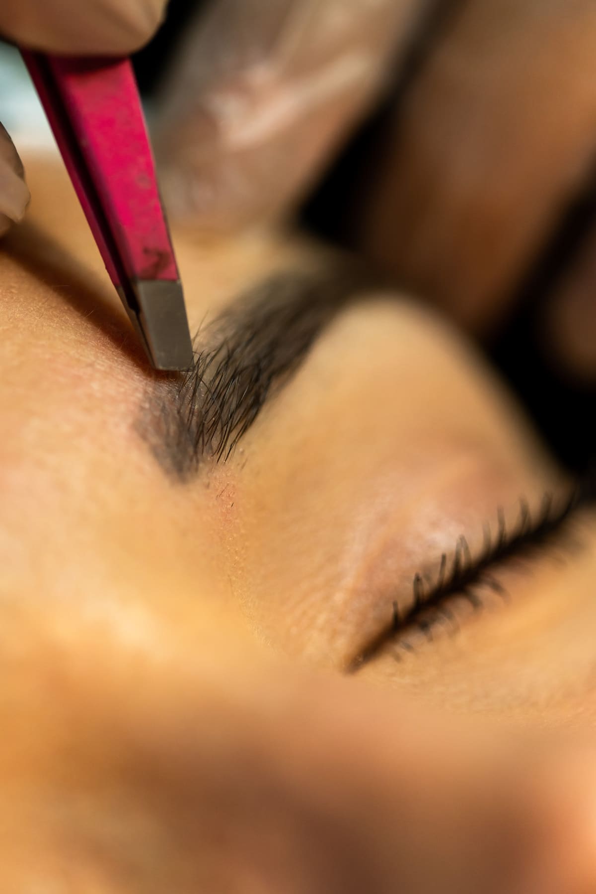 Laser hair removal treatment room